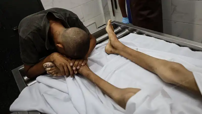 Gazze’de Acı Gerçek: Bir Çocuk Daha Açlıktan Hayatını Kaybetti